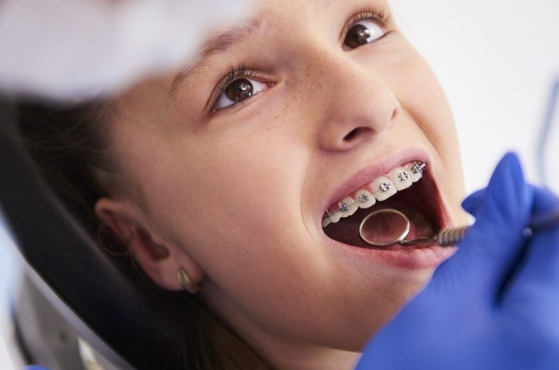 Can-a-Patient-with-Crowns-or-Bridges-Still-Get-Braces