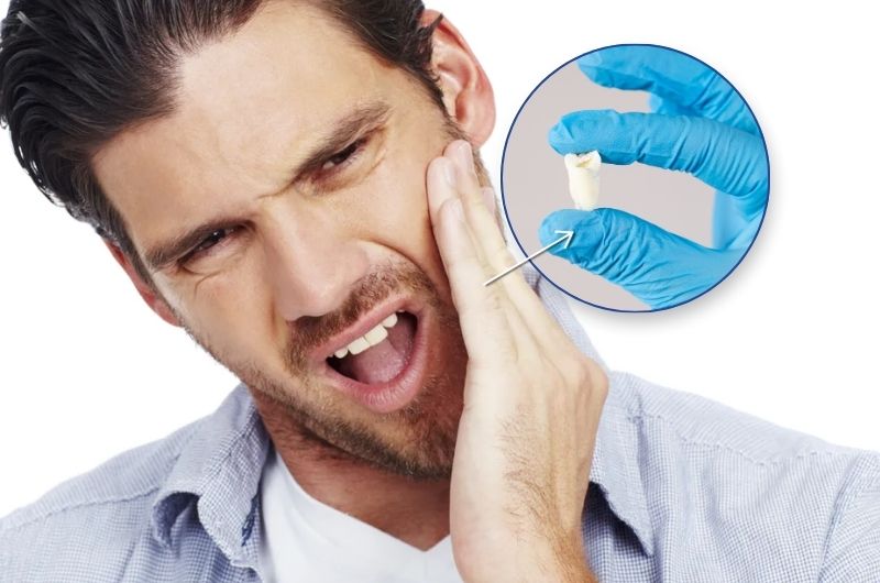 Is Wisdom Tooth Removal Essential? An In-Depth Look at the Benefits and Risks